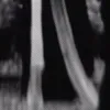 subnuaitia2