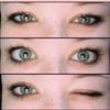lobotomy._.core