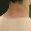 sonodalex