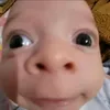 _dkizet6_