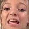 avas_crusty_toes