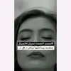 l_o_l_o141