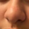 salkycolon5