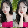 myxle04