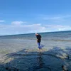 kentalbeos