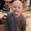 bald_malia