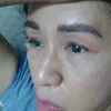 lakusinera