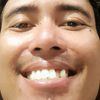 mastonyku15