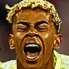 oxvem
