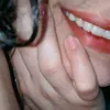 limmrafa