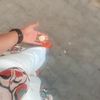 radiareta2