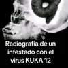 agus_canalla0
