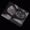 briz_09