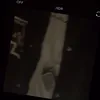 nhpisme_