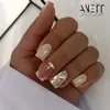 kiskis1908199336