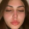 ms.anxiousbih