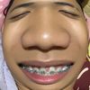 okayx101