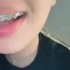 hmo_867