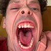 sterepk