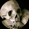 yorick_2