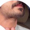 w1x11