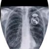 aboalteyp004