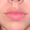 Mouth videos