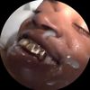 expiredspermcell