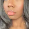 mhaliea