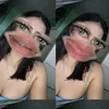 loraine