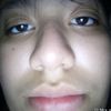 betoxdn