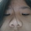 iris_adonis