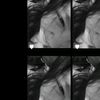 ilyfr_gloryyy