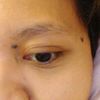 epygol1