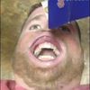 drfaggit