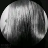 sntossfz