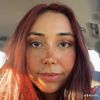 freckledxfleur