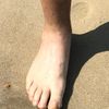 whitefoot1