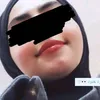 kw_xv