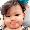 chickenpox59