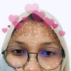 naevis4