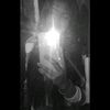 meleck..22rq