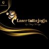 lasertattojogja