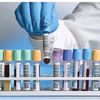 troponin911