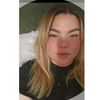 lyss.256