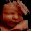 Krista | 3D Ultrasound Owner