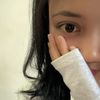 nciti