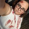fredericarwister9