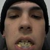 mejillast