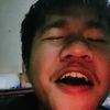aldinrr__